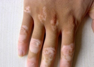 灿烂夏季,告别“白色恐怖”