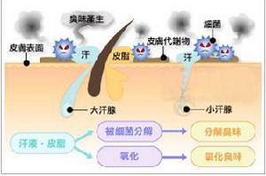 狐臭的病因与大汗腺的生理结构和功能有关吗 