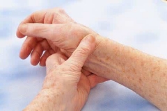 出现老年皮肤瘙痒症的原因 