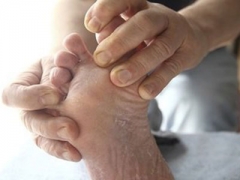 手足癣患者该怎么护理 