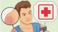 日光性皮炎有哪些症状