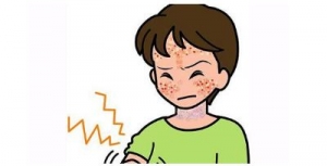 夏季预防日光性皮炎