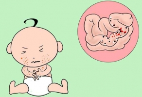 威海的皮肤专家让你远离宝宝过敏的问题 