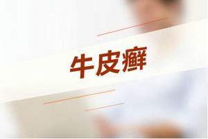青岛皮肤病专家讲解牛皮癣的危害