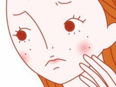 青岛秋季对痤疮的治疗办法是怎样科学化实施的