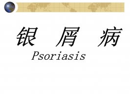 专家讲解银屑病的日常护理