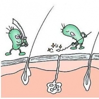 腋臭怎么治疗好的快 腋臭怎么治疗好的快