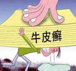 透彻认识牛皮癣疾患产生的危害