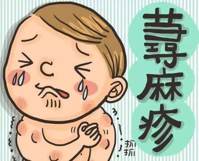 慢性荨麻疹的症状图