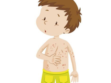 慢性湿疹产生的原因与症状表现 