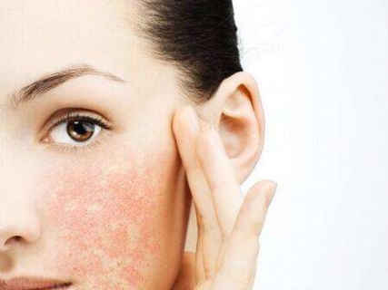 皮肤发生过敏是怎么造成的 